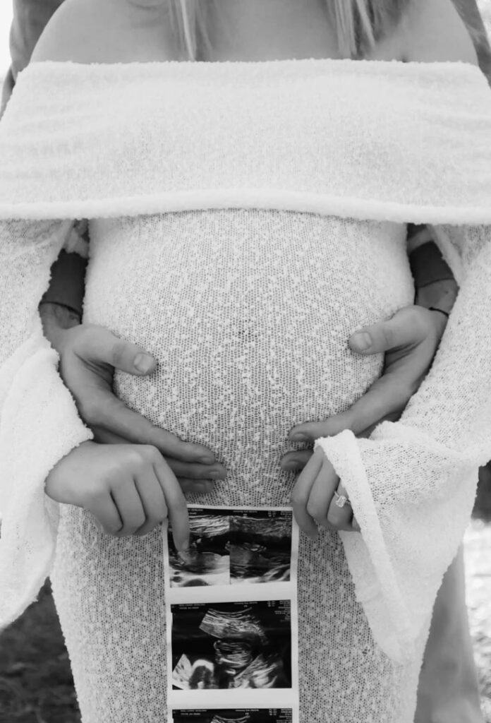 baby bump photo ideas